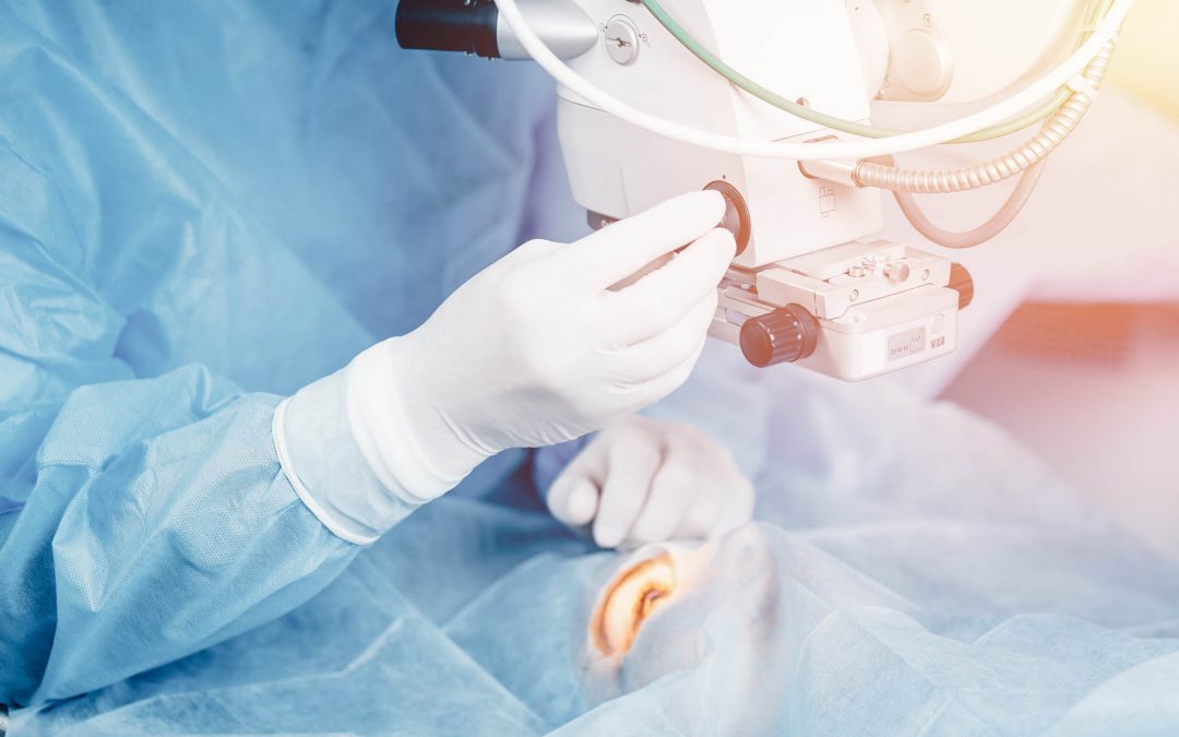 Quelle est la durée de la chirurgie des yeux au laser ?