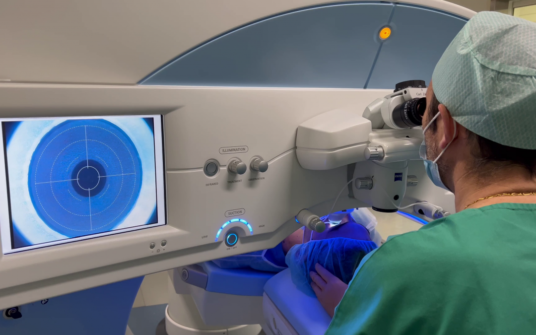 L’opération au laser des yeux est-elle douloureuse ?